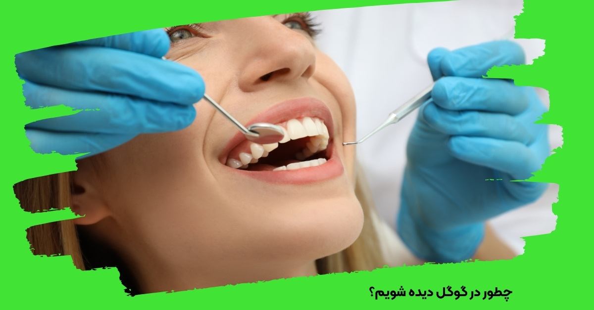 چطور در گوگل دیده شویم؟