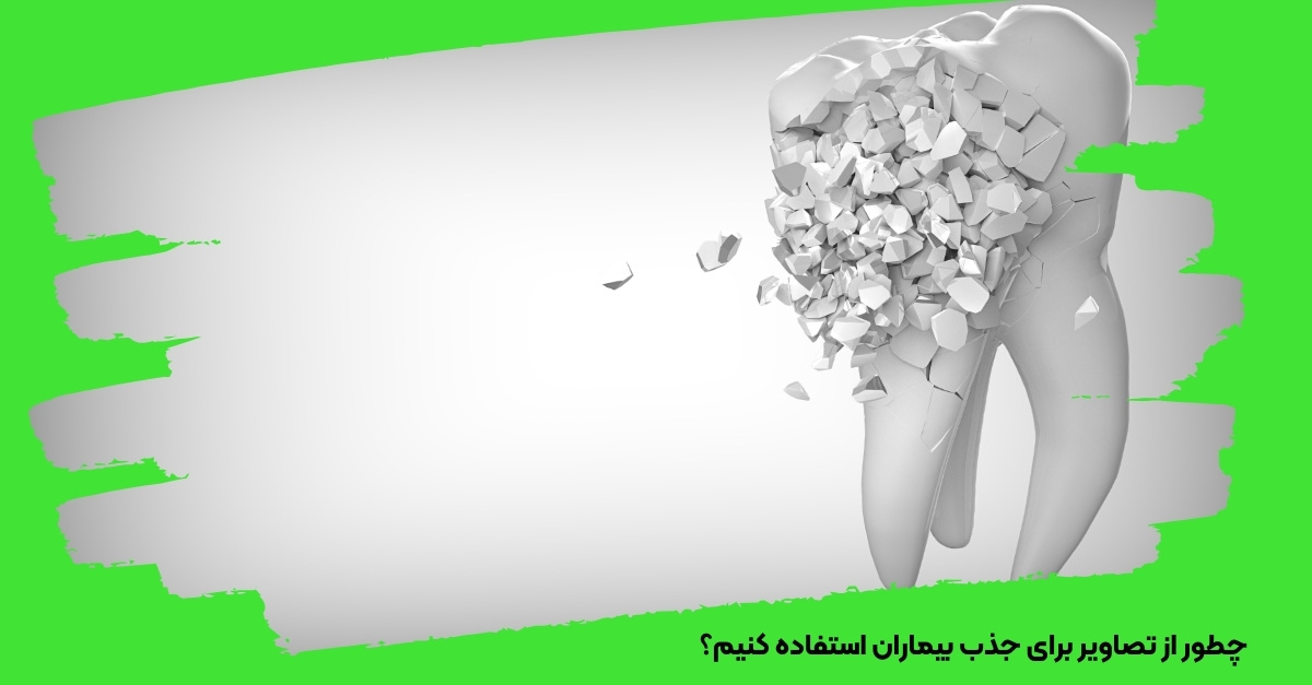 چطور از تصاویر برای جذب بیماران استفاده کنیم؟